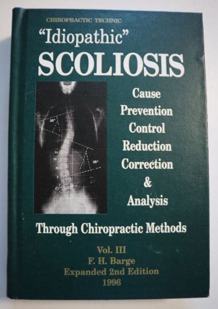 Idiopathic Scoliosis Idiopathic Scoliosis